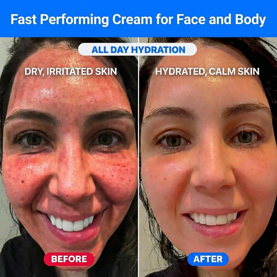 Barrier repair moisturizer bottle for damaged skin