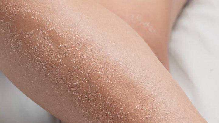 Dr. Arsy Face Moisturizer and Face Eczema Cream 003 for sensitive, hypoallergenic, eczema-prone skin; applying Dr. Arsy eczema moisturizer for hydration and barrier support on sensitive skin; texture of Dr. Arsy barrier repair moisturizing cream for dry, sensitive, eczema-prone skin; barrier-supporting ingredients in Dr. Arsy eczema hydration and repair moisturizer; Dr. Arsy certifications including National Eczema Association Seal of Acceptance and Leaping Bunny cruelty-free; hydration & barrier-repair.